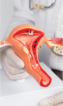 Fibroid embolization