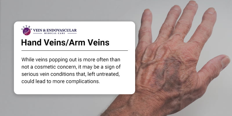 Hand Veins-Arm Veins