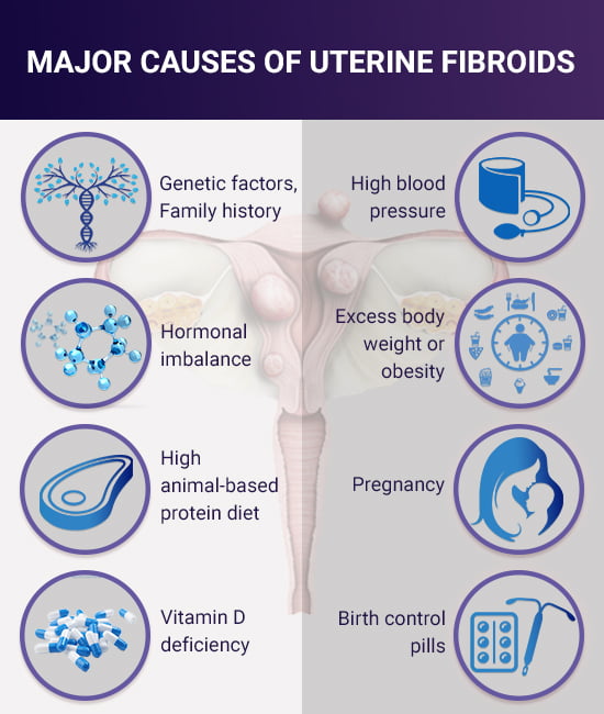 Major causes of uterine fibroids