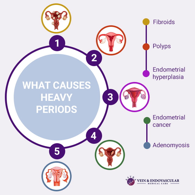What Causes Heavy Periods