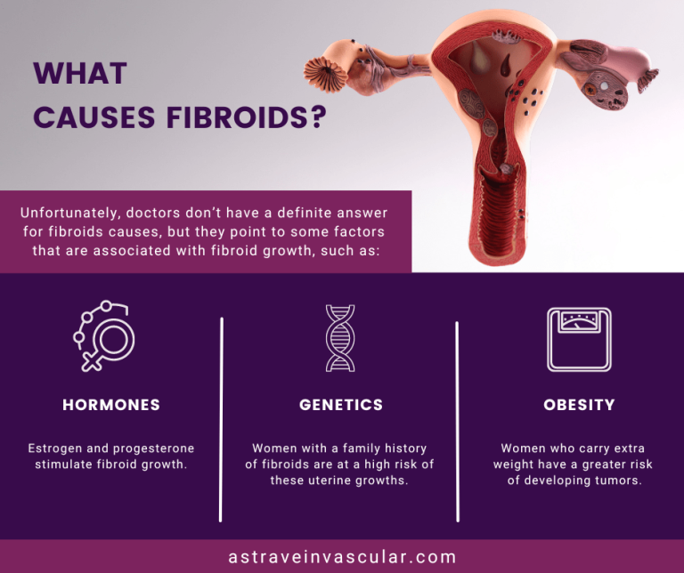 Fibroid Pain Relief in Brooklyn, NY and Bronx, NY Vein & Endovascular