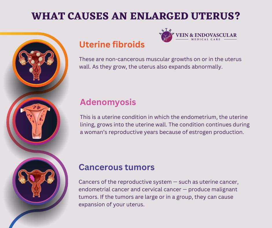 Bulky Uterus: Symptoms, Causes and Treatment