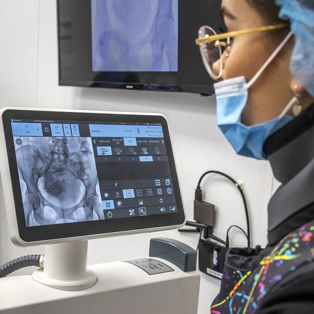 Uterine Fibroids Treatment in Brooklyn, NY and Bronx, NY