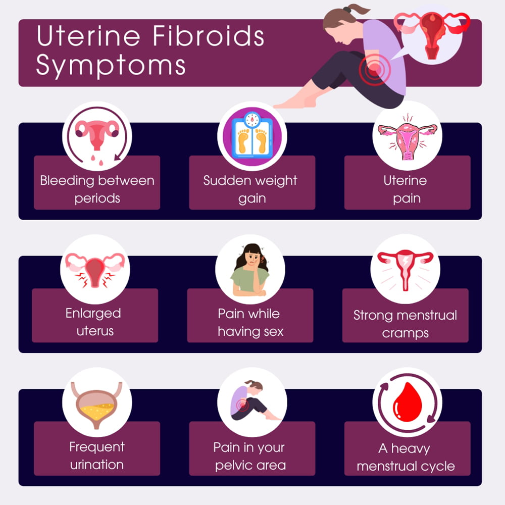 What Are Fibroids Symptoms