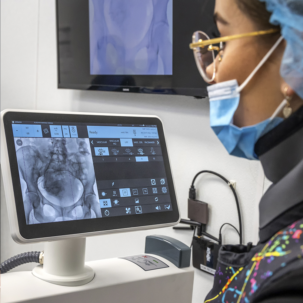 Fibroid Treatment Specialists in Brooklyn