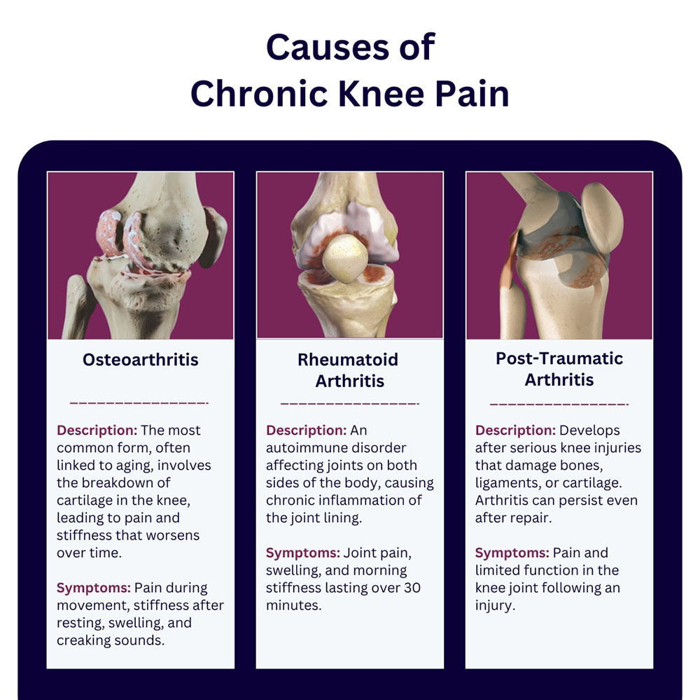 Causes of Chronic Knee Pain